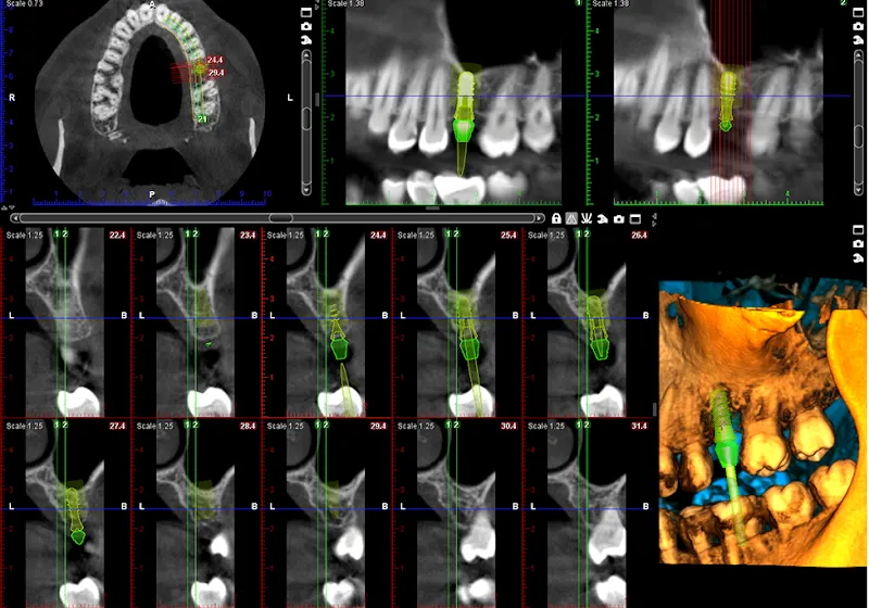 C3D Salamanca - Centro Diagnostico Avanzado (Odontología Digital) - Salamanca