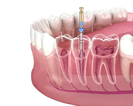 Centro Dental Hernández