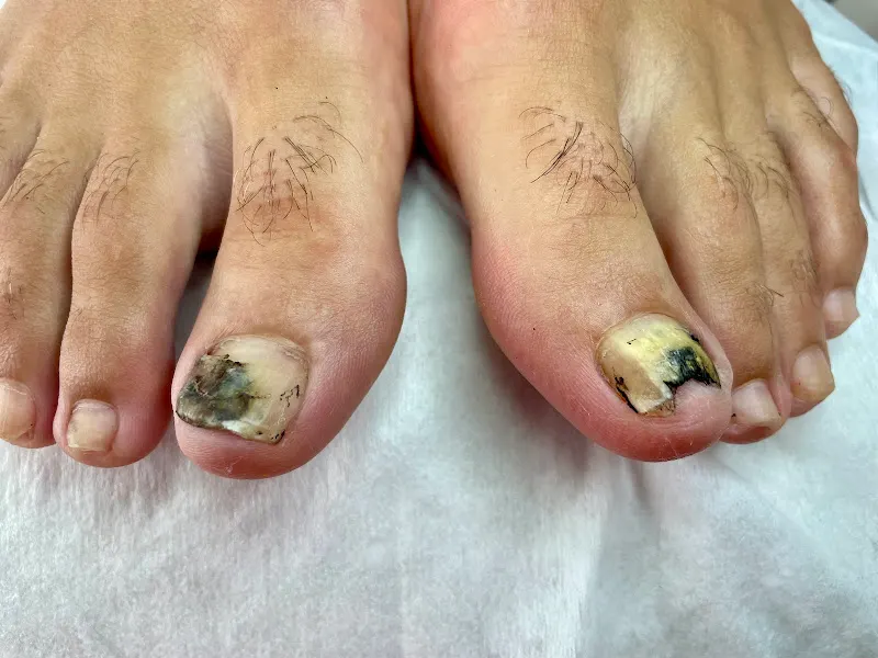 Destrezza - Salamanca - Cuidado de los pies en Salamanca - foto 2